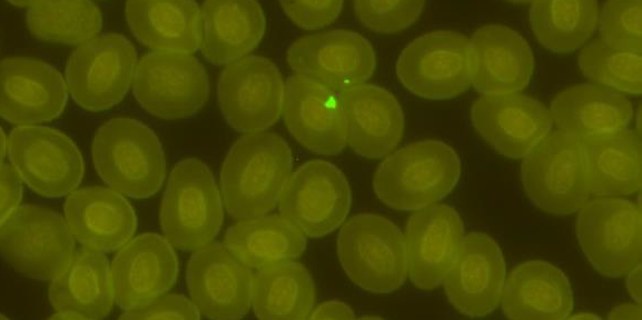 PRV-3 antigen in erythrocyte cytoplasm of rainbow trout